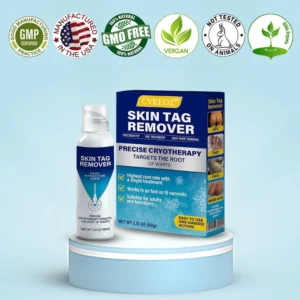 CVREOZ® TagRecede Cryo Treatment Spray