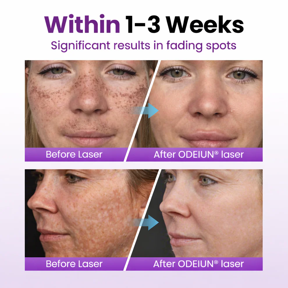 ODEIUN® Spot Erasure Probiotic Shield Serum image ODEIUN® Spot Erasure Probiotic Shield Serum