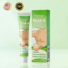 Cvreoz® Knot-X Lipoma Dissolve Cream image Cvreoz® Knot-X Lipoma Dissolve Cream