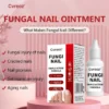 Cvreoz® Toenail Fungus Treatment image Cvreoz® Toenail Fungus Treatment