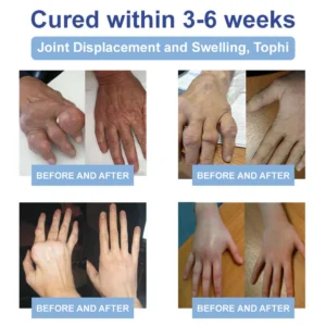 LOVILDS™ Black Rice Pain Healing Bone Cream