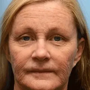 Rolimey® Botox & Vita-A Retinol Shot Wrinkle-Lift Tightening cream image Rolimey® Botox & Vita-A Retinol Shot Wrinkle-Lift Tightening cream