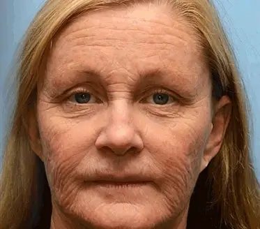 Rolimey® Botox & Vita-A Retinol Shot Wrinkle-Lift Tightening cream image Rolimey® Botox & Vita-A Retinol Shot Wrinkle-Lift Tightening cream - Image 14