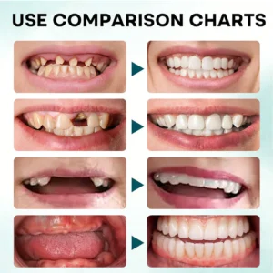 NESLEMY® Firm Hold Denture Adhesive