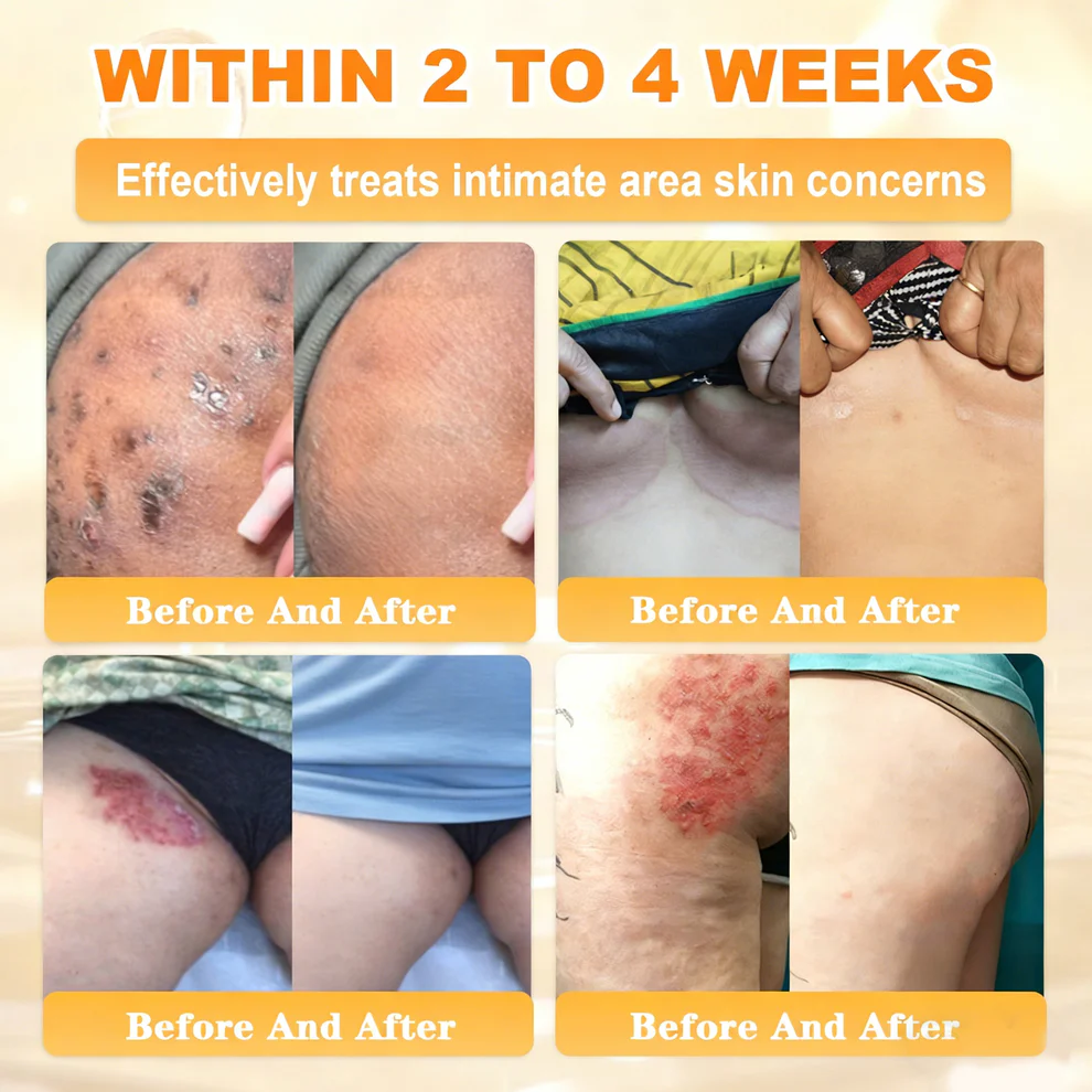 Tiworld Bee Venom Propolis Multi-Action Skin Repair Cream - Image 10