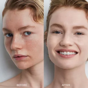 LIMETOW™ Bleaching Cream image LIMETOW™ Bleaching Cream