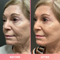 LIMETOW™ Compact Anti-wrinkle Bar image LIMETOW™ Compact Anti-wrinkle Bar