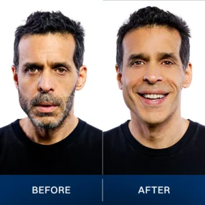 LIMETOW® 2025 New Upgrade Pocket Shaver image LIMETOW® 2025 New Upgrade Pocket Shaver