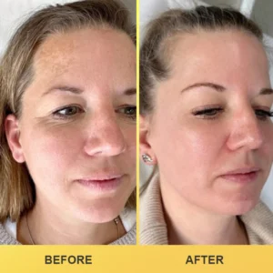 LIMETOW® Revive Eye Cream