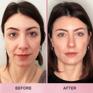 LIMETOW™ Multi Collagen Balm Stick