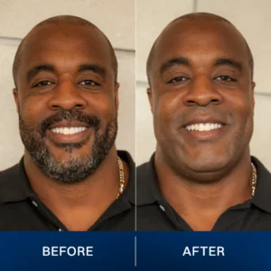 LIMETOW® 2025 New Upgrade Pocket Shaver image LIMETOW® 2025 New Upgrade Pocket Shaver