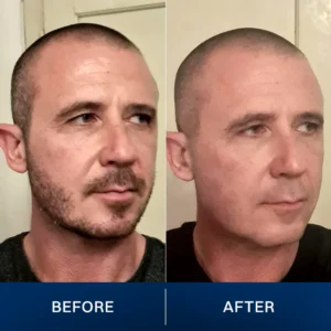 LIMETOW® 2025 New Upgrade Pocket Shaver image LIMETOW® 2025 New Upgrade Pocket Shaver