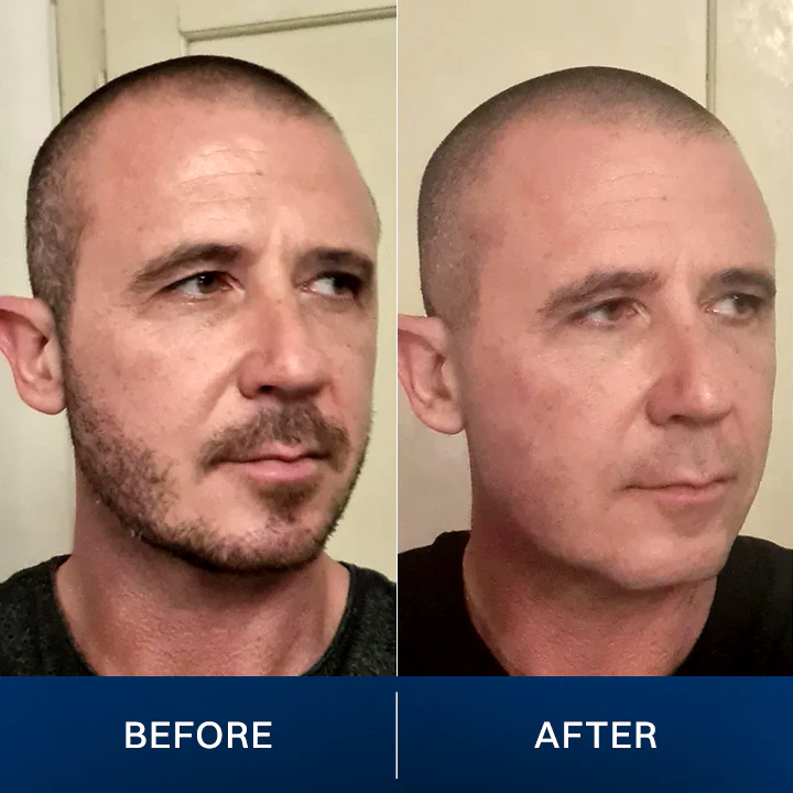 LIMETOW® 2025 New Upgrade Pocket Shaver image LIMETOW® 2025 New Upgrade Pocket Shaver - Image 7