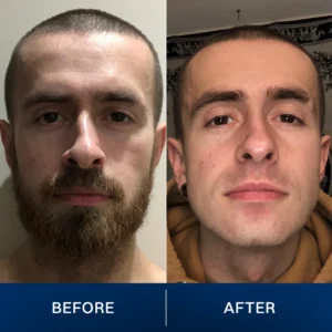 LIMETOW® 2025 New Upgrade Pocket Shaver image LIMETOW® 2025 New Upgrade Pocket Shaver