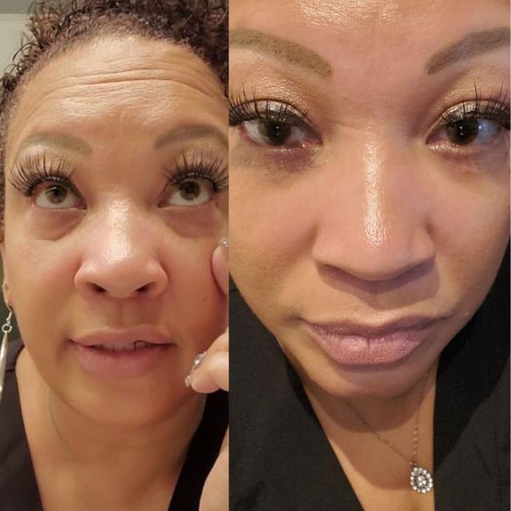 Bright Up - Smooths out wrinkles instantly