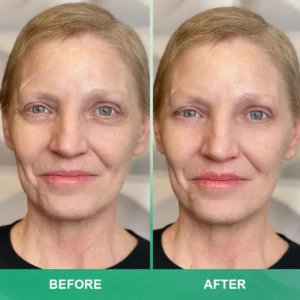 LIMETOW™ Anti-wrinkle Cream Stick