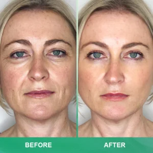 LIMETOW™ Anti-wrinkle Cream Stick