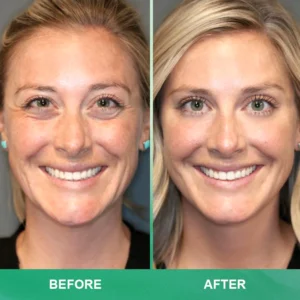 LIMETOW™ Anti-wrinkle Cream Stick