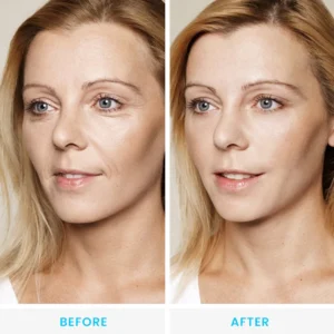 LIMETOW™ Collagen, Retinol & Hyaluronic Acid Cream image LIMETOW™ Collagen, Retinol & Hyaluronic Acid Cream