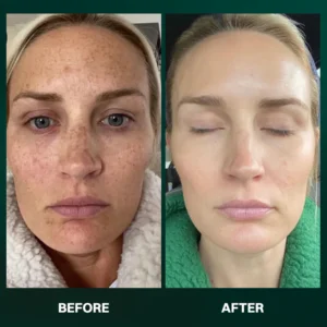 LIMETOW® α-Arbutin Whitening Serum