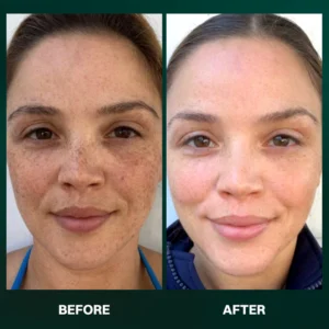 LIMETOW® α-Arbutin Whitening Serum