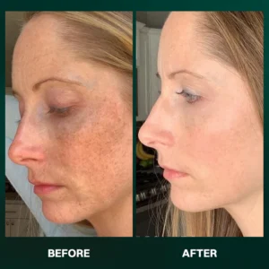 LIMETOW® α-Arbutin Whitening Serum