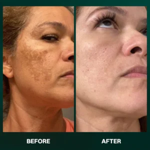 LIMETOW® α-Arbutin Whitening Serum