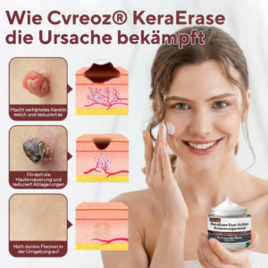 Cvreoz® KeraErase Dual-Action Renewal Cream