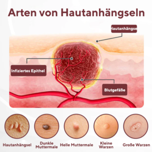 Cvreoz® KeraErase Dual-Action Renewal Cream