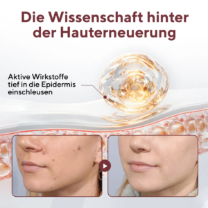 Cvreoz® KeraErase Dual-Action Renewal Cream