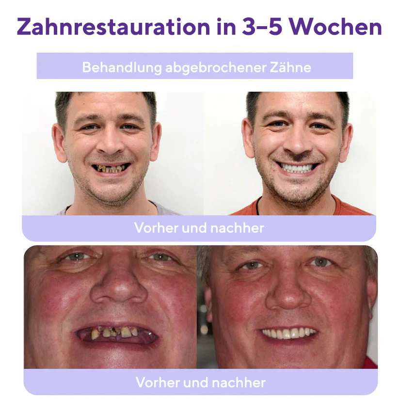 Fivfivgo® Dental Restoration Mineral Powder