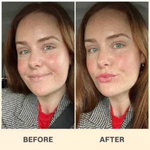 LIMETOW® PROPOLIS LIP BALM