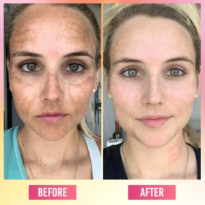 LIMETOW® Face Bright Serum In Cream