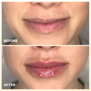 LIMETOW® PROPOLIS LIP BALM