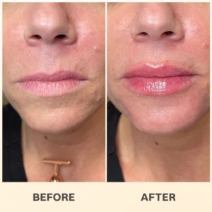 LIMETOW® PROPOLIS LIP BALM