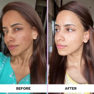 LIMETOW™ Bleaching Cream image LIMETOW™ Bleaching Cream