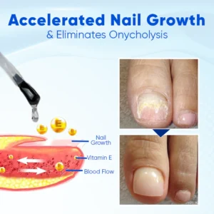 Biancat™ OnyxoGuard Nail Growth and Repair Serum image Biancat™ OnyxoGuard Nail Growth and Repair Serum