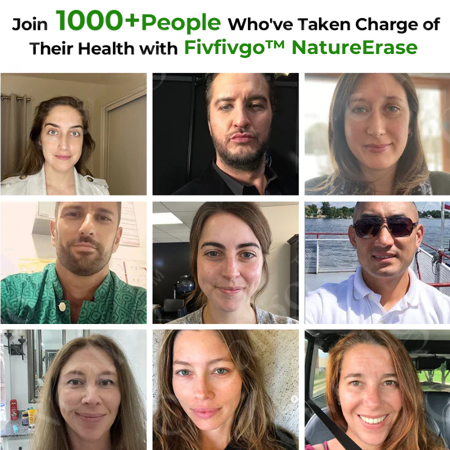 Fivfivgo™ NatureErase Instant Mole & Spot Cream