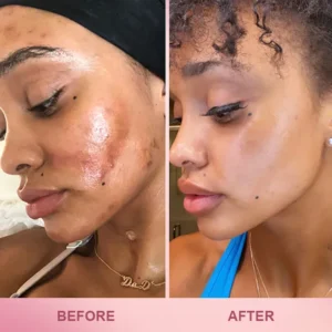 LIMETOW™ Whitening Skin Stick image LIMETOW™ Whitening Skin Stick