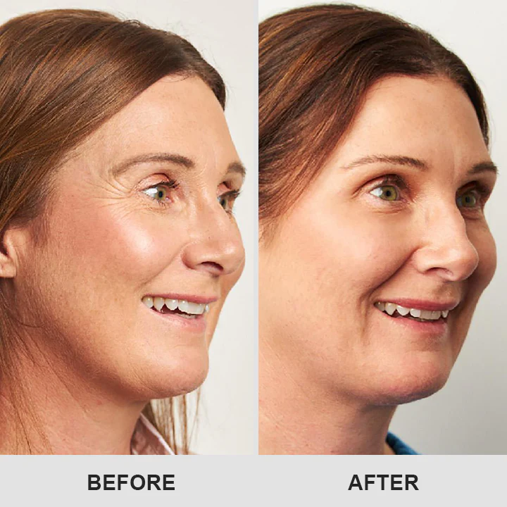 LIMETOW™ Retinol Eye Stick image LIMETOW™ Retinol Eye Stick