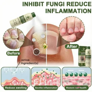 TAILEDEN Magnesium Herbal Psoriasis Spray