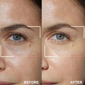 LIMETOW™ Retinol Eye Stick image LIMETOW™ Retinol Eye Stick