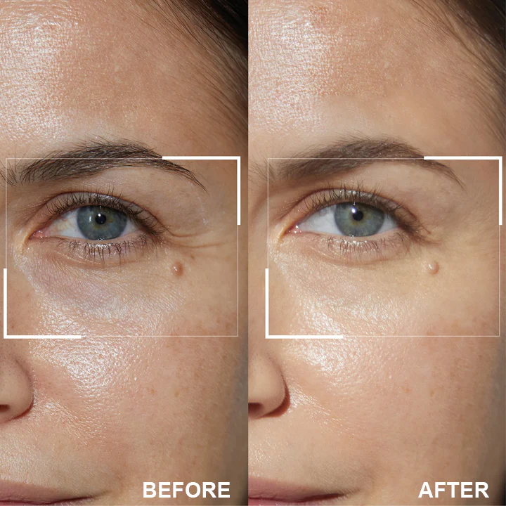 LIMETOW™ Retinol Eye Stick image LIMETOW™ Retinol Eye Stick - Image 11