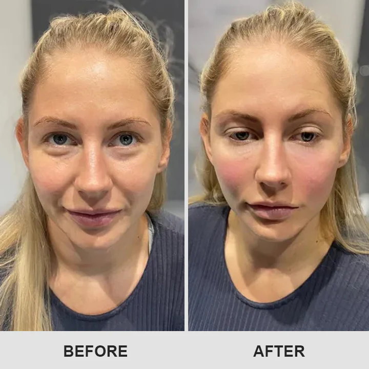 LIMETOW™ Retinol Eye Stick image LIMETOW™ Retinol Eye Stick - Image 10