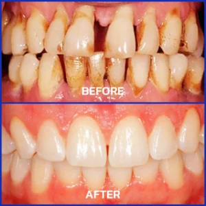 Alisanda® Bee Venom Dental Treatment Toothpaste image Alisanda® Bee Venom Dental Treatment Toothpaste