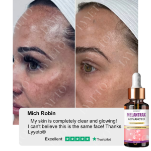 Lyyeto® MelantraX Advanced Brightening Essence ACE