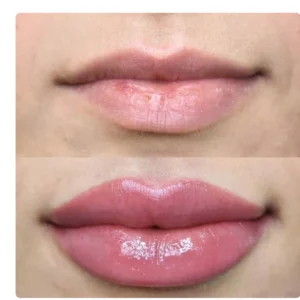 Instant Lip Plumper