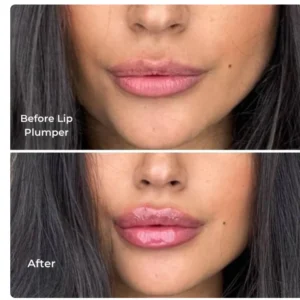 Instant Lip Plumper