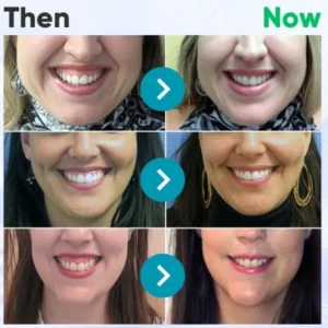 Alisanda® Bee Venom Dental Treatment Toothpaste image Alisanda® Bee Venom Dental Treatment Toothpaste