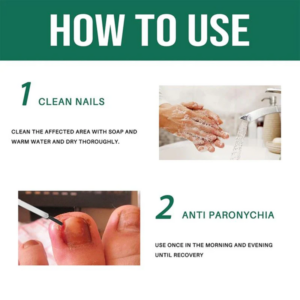 Rubriel Anti Paronychia Relief Oil